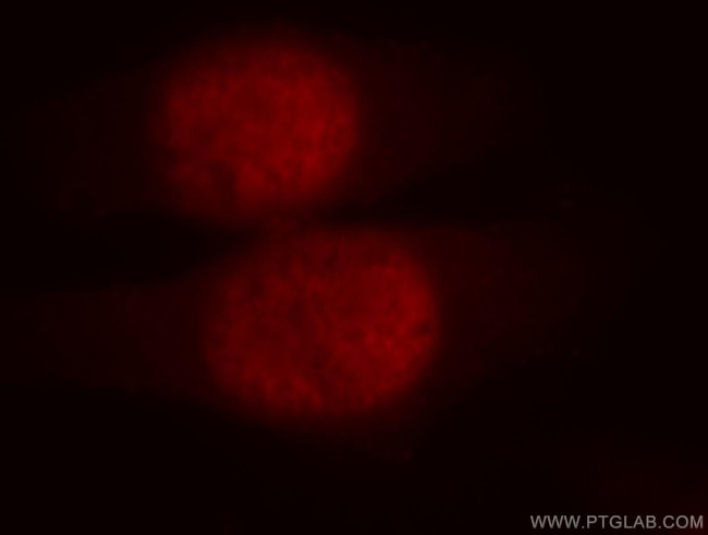 UBR2 Antibody in Immunocytochemistry (ICC/IF)