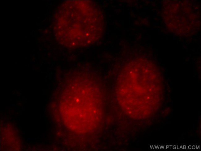 UBR2 Antibody in Immunocytochemistry (ICC/IF)