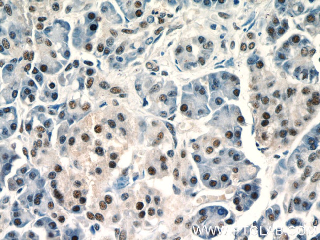 UBR2 Antibody in Immunohistochemistry (Paraffin) (IHC (P))