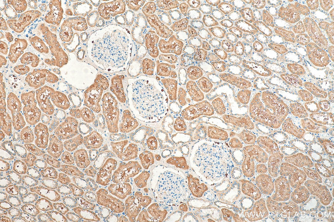 MRPS17 Antibody in Immunohistochemistry (Paraffin) (IHC (P))