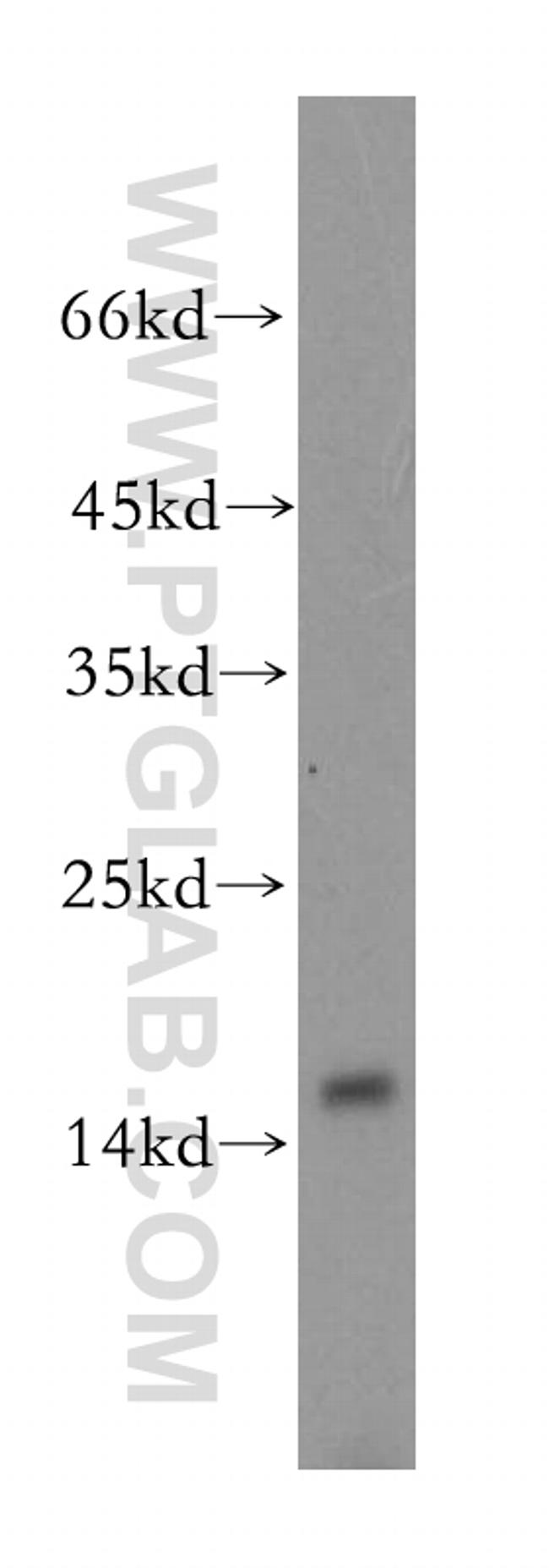 MRPS17 Antibody in Western Blot (WB)