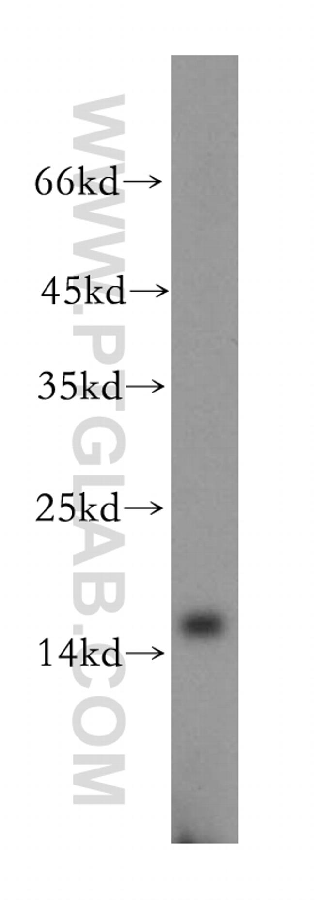 MRPS17 Antibody in Western Blot (WB)