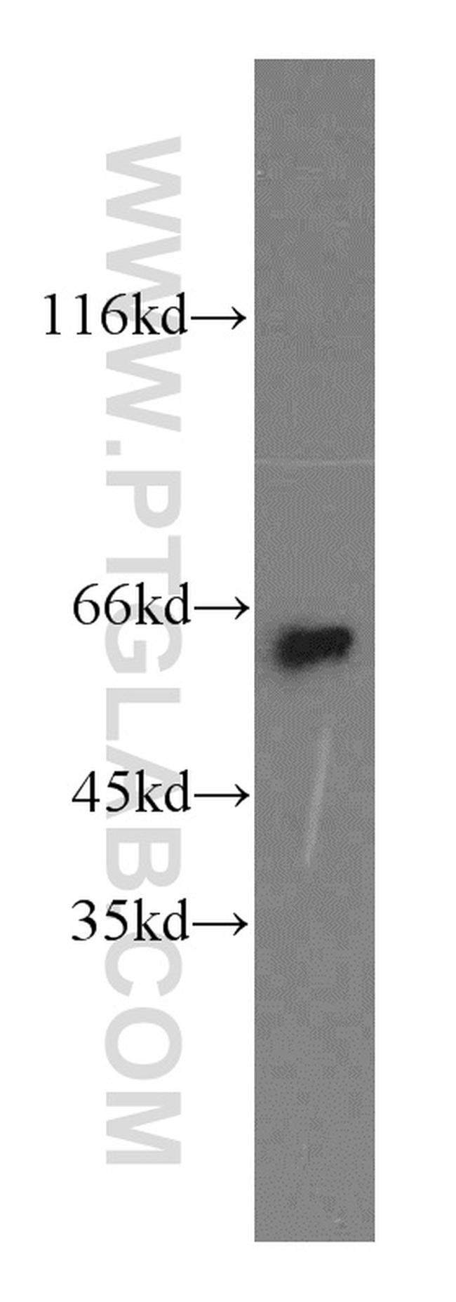 NEURL Antibody in Western Blot (WB)