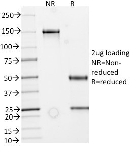 IgA Secretory Component/ECM1 Antibody in SDS-PAGE (SDS-PAGE)
