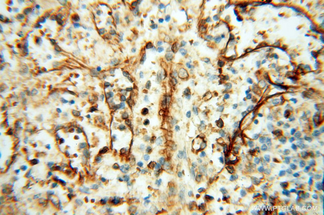 SPZ1 Antibody in Immunohistochemistry (Paraffin) (IHC (P))