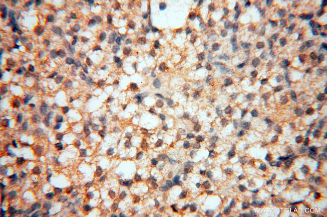 SPZ1 Antibody in Immunohistochemistry (Paraffin) (IHC (P))