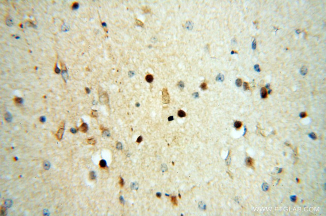 SPZ1 Antibody in Immunohistochemistry (Paraffin) (IHC (P))