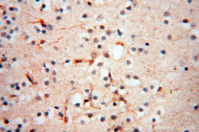 SPZ1 Antibody in Immunohistochemistry (Paraffin) (IHC (P))