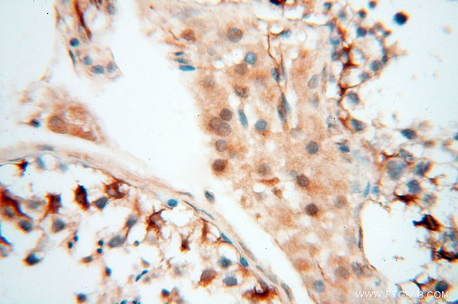 SPZ1 Antibody in Immunohistochemistry (Paraffin) (IHC (P))