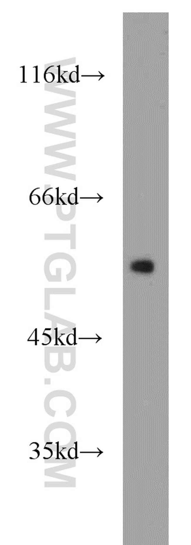 SPZ1 Antibody in Western Blot (WB)