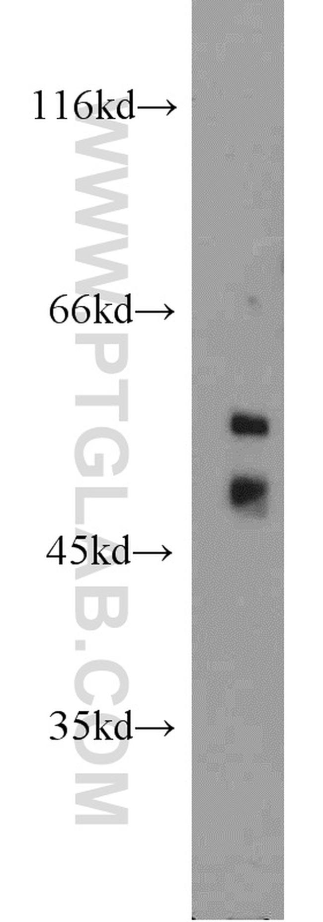 SPZ1 Antibody in Western Blot (WB)