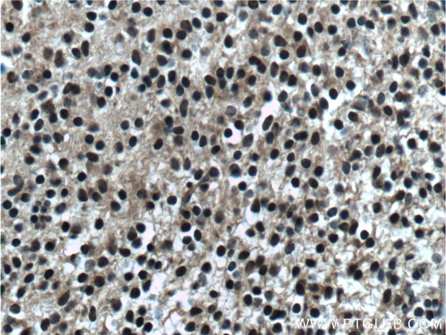 MYOD1 Antibody in Immunohistochemistry (Paraffin) (IHC (P))