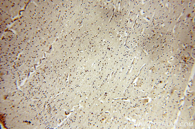 MYOD1 Antibody in Immunohistochemistry (Paraffin) (IHC (P))