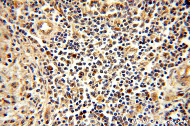 MYOD1 Antibody in Immunohistochemistry (Paraffin) (IHC (P))