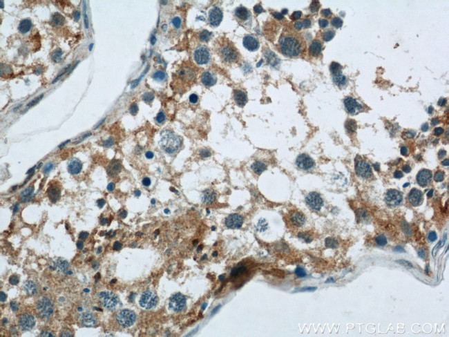 PAOX Antibody in Immunohistochemistry (Paraffin) (IHC (P))