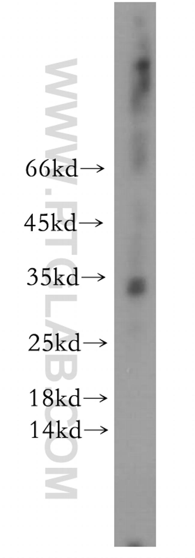 RTP1 Antibody in Western Blot (WB)