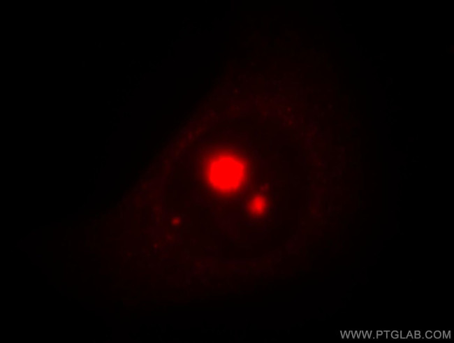 TXK Antibody in Immunocytochemistry (ICC/IF)