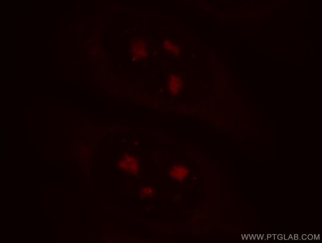 TXK Antibody in Immunocytochemistry (ICC/IF)