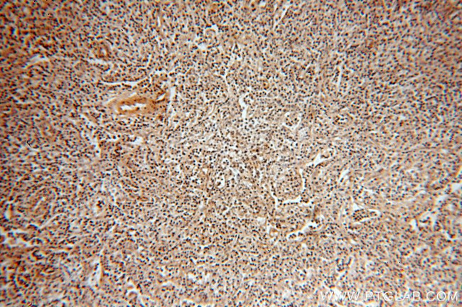 TXK Antibody in Immunohistochemistry (Paraffin) (IHC (P))