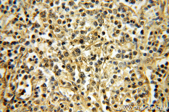 TXK Antibody in Immunohistochemistry (Paraffin) (IHC (P))