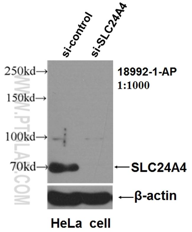 SLC24A4 Antibody in Western Blot (WB)