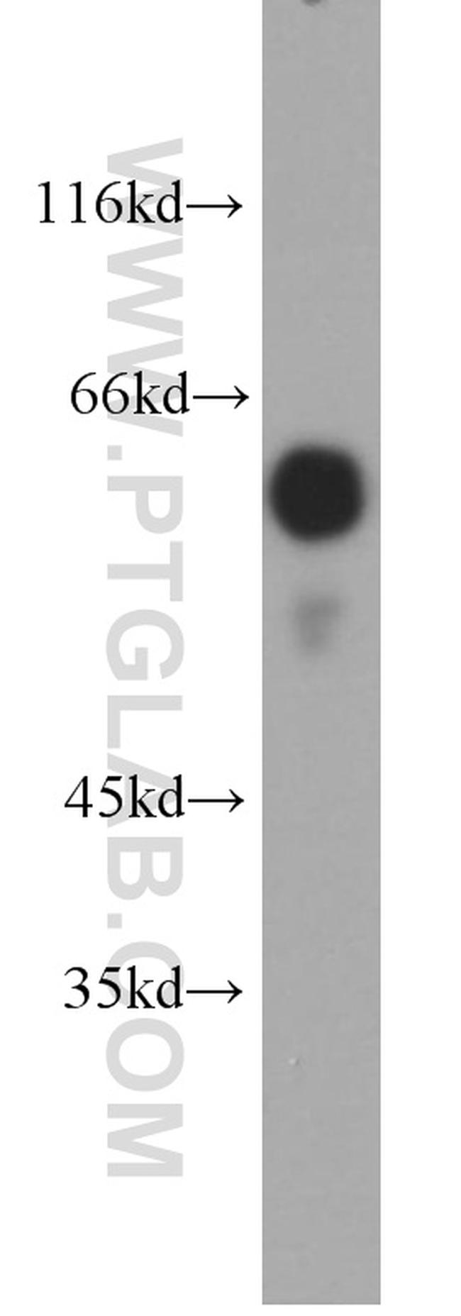 OCT2 Antibody in Western Blot (WB)