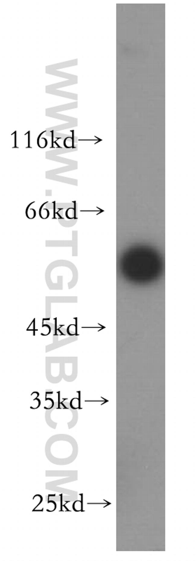 OCT2 Antibody in Western Blot (WB)