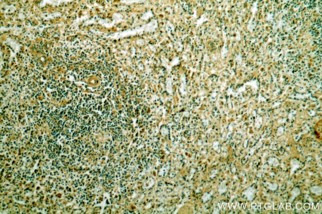 OCT2 Antibody in Immunohistochemistry (Paraffin) (IHC (P))