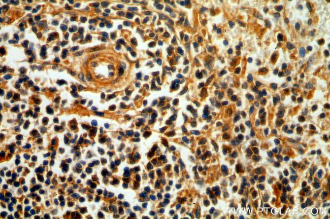 OCT2 Antibody in Immunohistochemistry (Paraffin) (IHC (P))