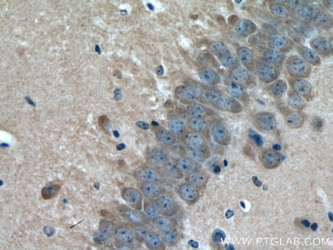 GUCY1B3 Antibody in Immunohistochemistry (Paraffin) (IHC (P))