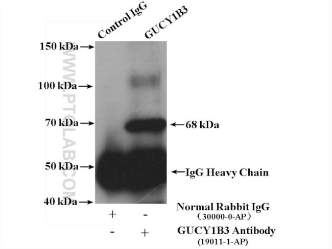 GUCY1B3 Antibody in Immunoprecipitation (IP)