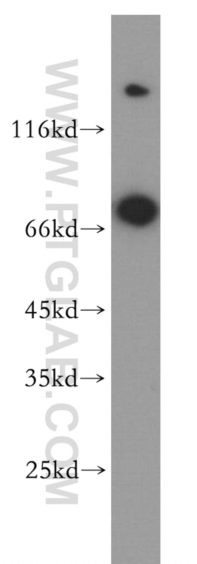 GUCY1B3 Antibody in Western Blot (WB)