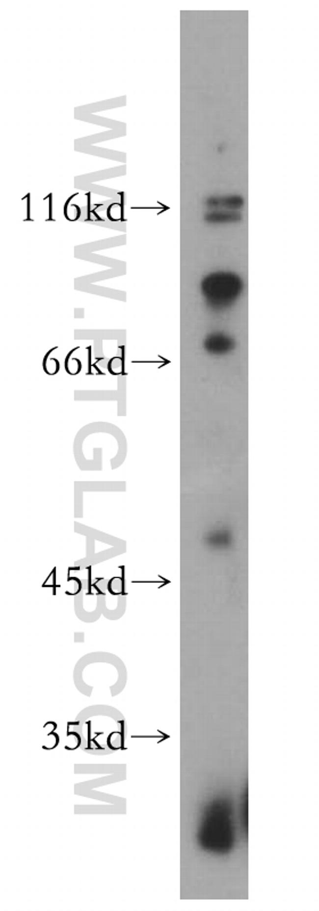 P2RX5 Antibody in Western Blot (WB)