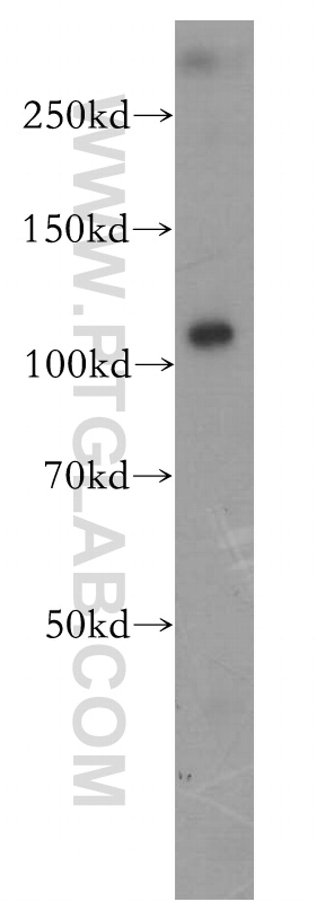 P2RX5 Antibody in Western Blot (WB)