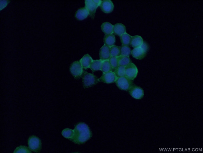 P2RX5 Antibody in Immunocytochemistry (ICC/IF)