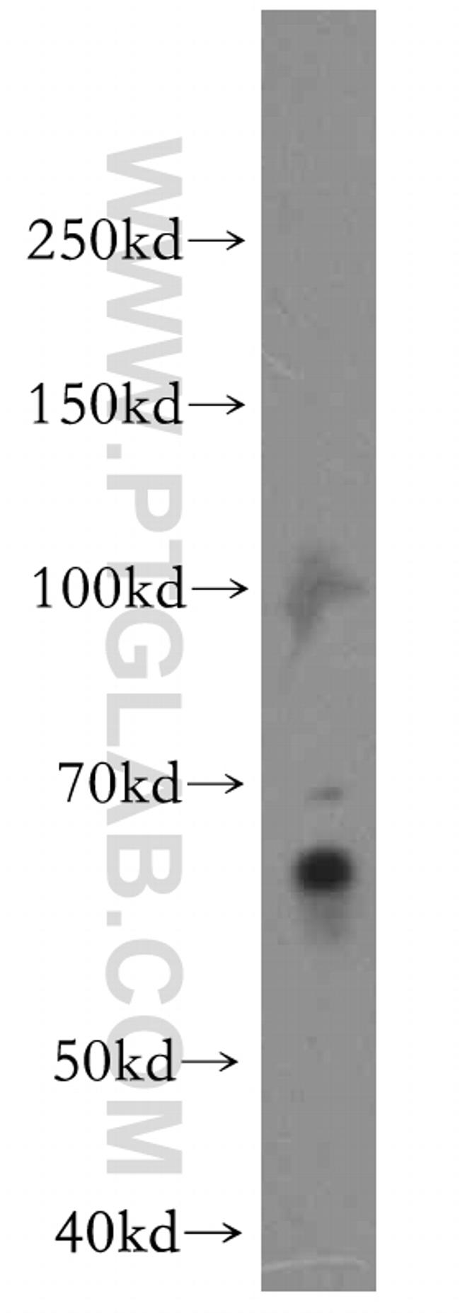 IKZF3 Antibody in Western Blot (WB)