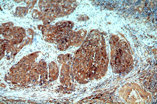 ARSA Antibody in Immunohistochemistry (Paraffin) (IHC (P))