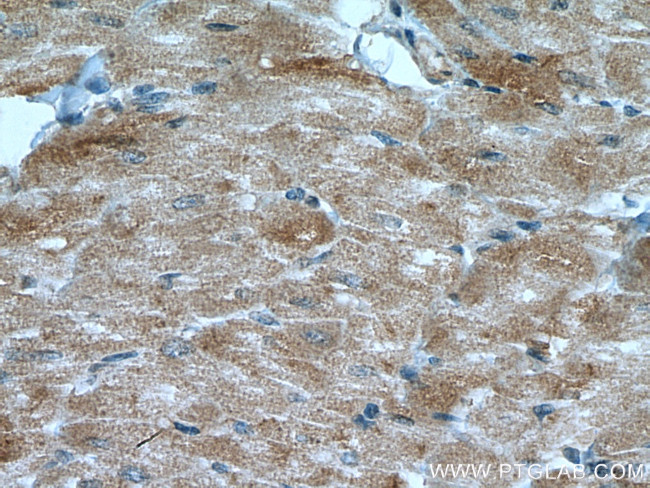 BMPR2 Antibody in Immunohistochemistry (Paraffin) (IHC (P))