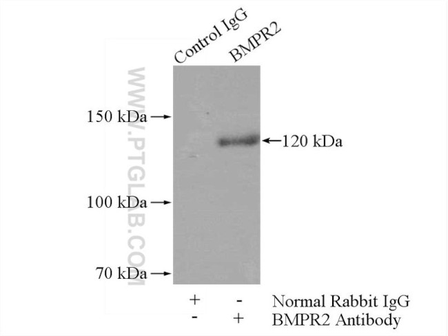 BMPR2 Antibody in Immunoprecipitation (IP)