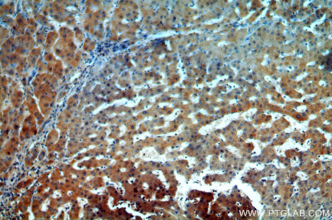 ALPK1 Antibody in Immunohistochemistry (Paraffin) (IHC (P))