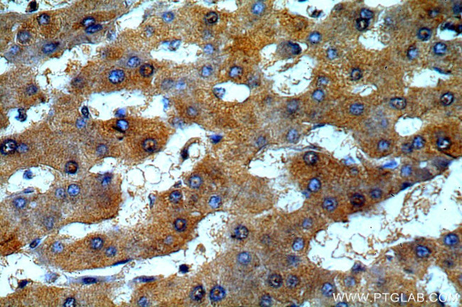 ALPK1 Antibody in Immunohistochemistry (Paraffin) (IHC (P))