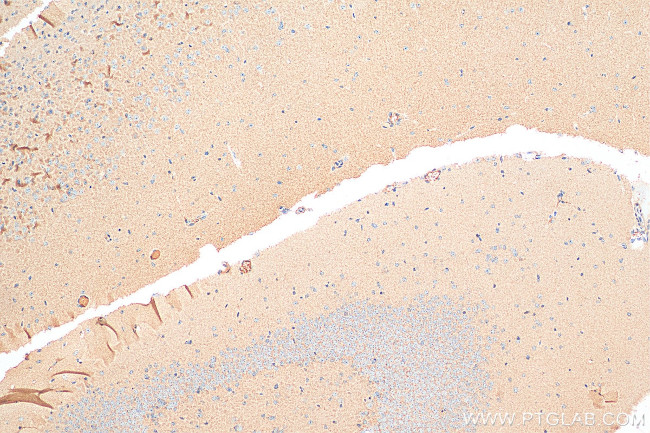 ALPK1 Antibody in Immunohistochemistry (Paraffin) (IHC (P))