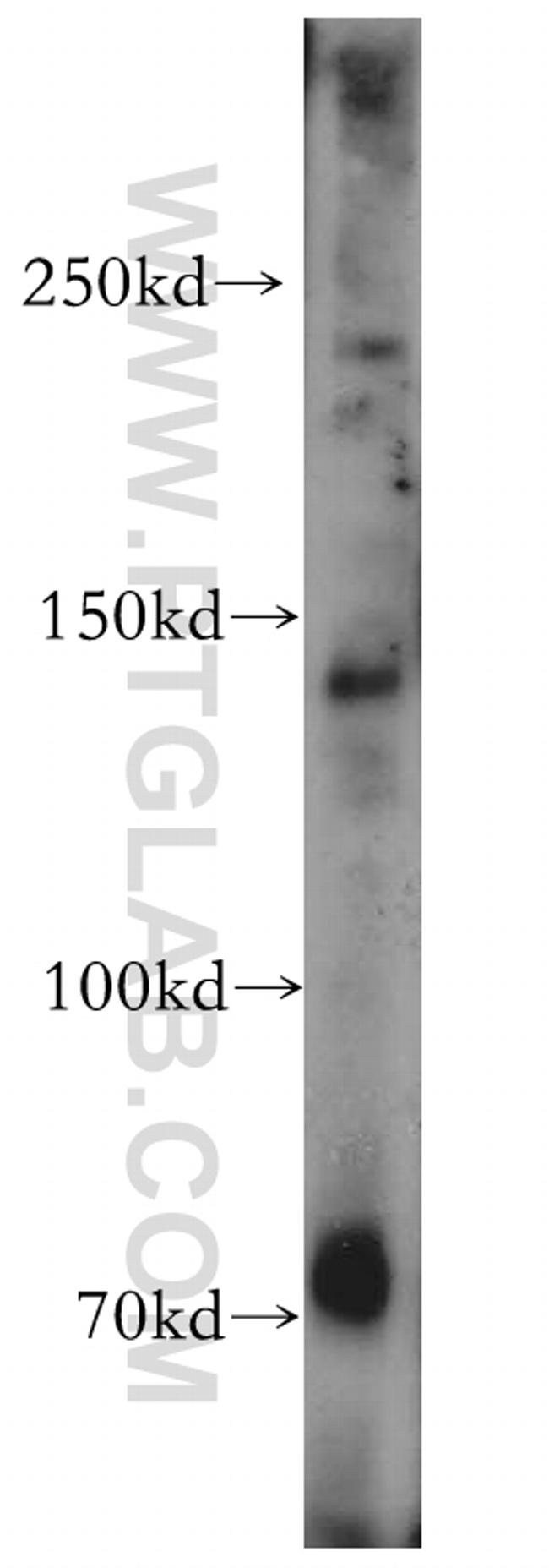 ALPK1 Antibody in Western Blot (WB)