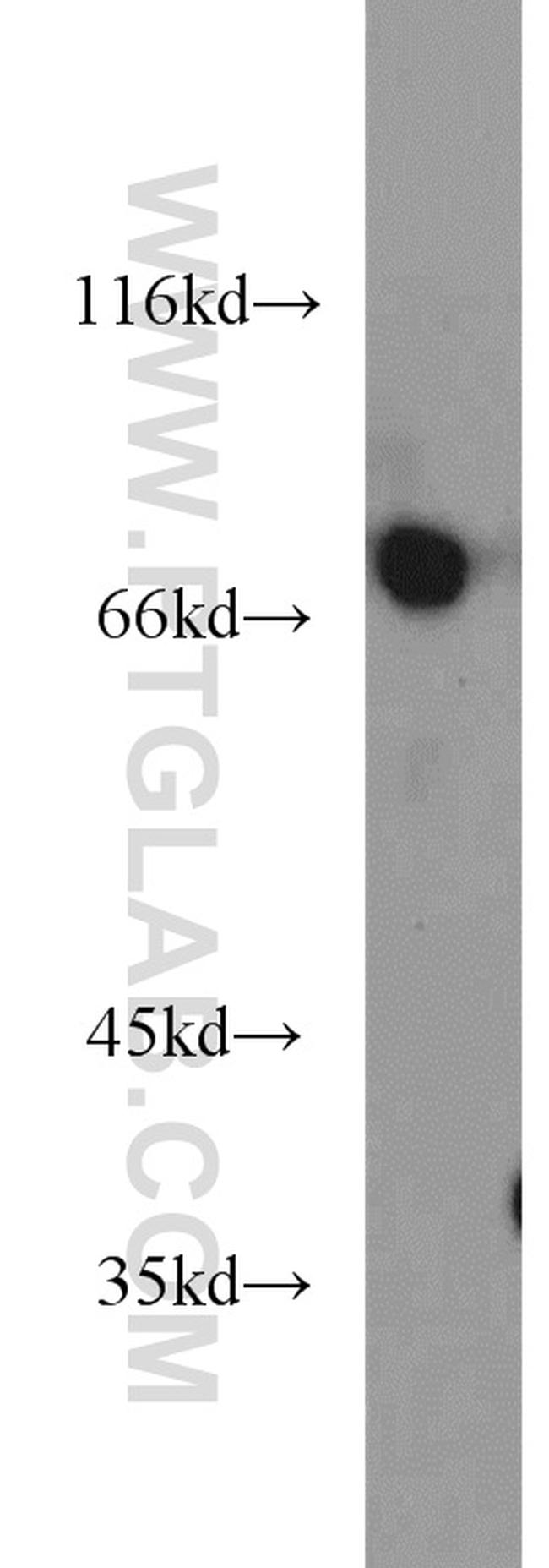SEMA3C Antibody in Western Blot (WB)