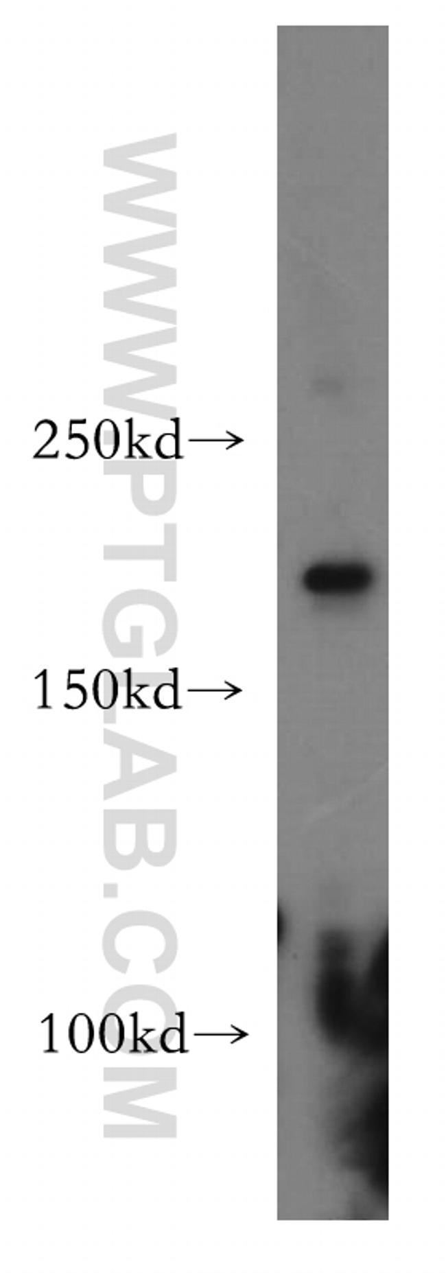 HCFC1 Antibody in Western Blot (WB)