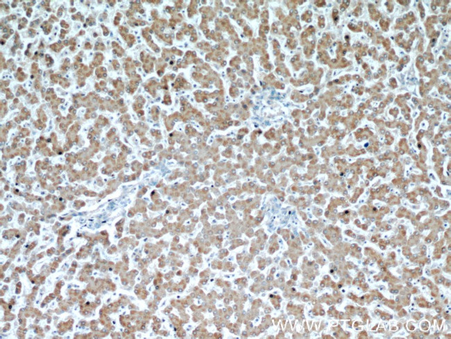 NUP85 Antibody in Immunohistochemistry (Paraffin) (IHC (P))