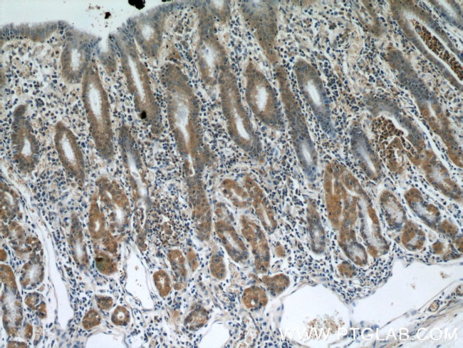 NUP85 Antibody in Immunohistochemistry (Paraffin) (IHC (P))