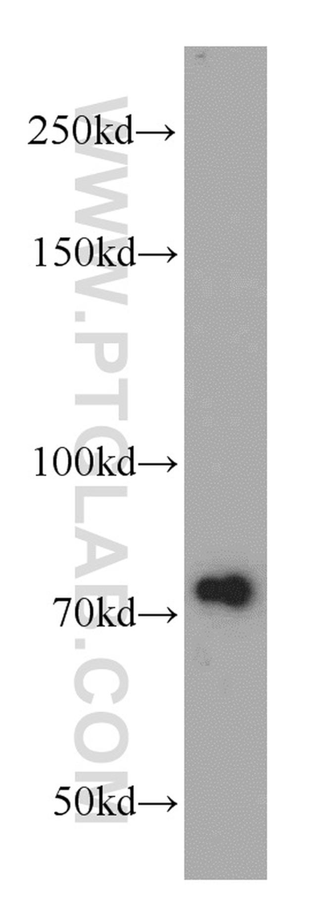 NUP85 Antibody in Western Blot (WB)