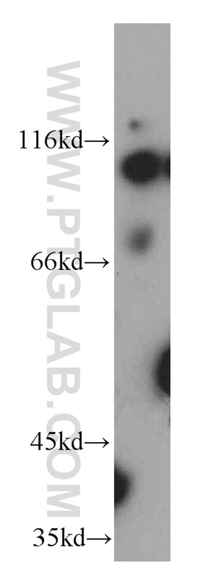 USP10 Antibody in Western Blot (WB)