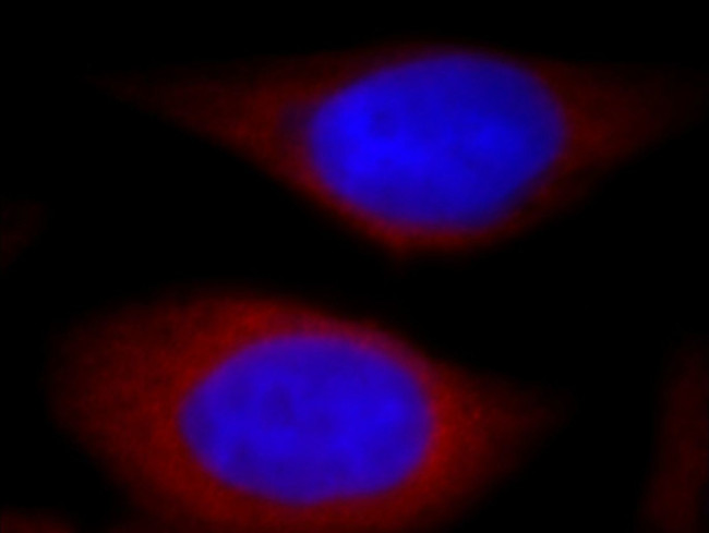 PIH1D1 Antibody in Immunocytochemistry (ICC/IF)